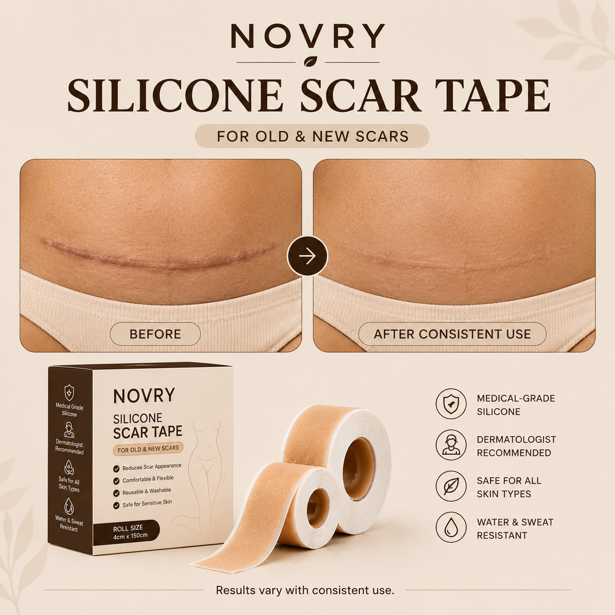 Novry Scar Removing Treatment